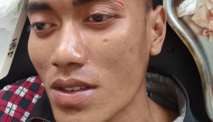 Niat Hati Ingin Mandi di Pemandian, Pria Asal Desa Bringin Jadi Korban Pemuda Sok Jagoan, Ini Kronologinya
