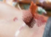 5 Orang Warga Desa Sepanjang, Kecamatan Sapeken Diduga Menjadi Korban Penganiayaan Bersama-Sama, Begini Kronologinya