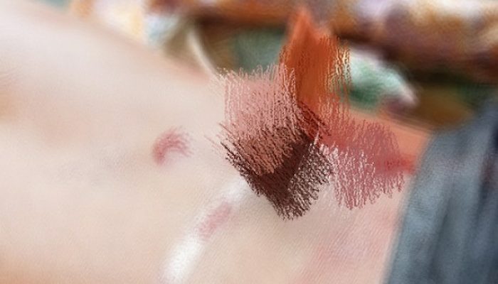 5 Orang Warga Desa Sepanjang, Kecamatan Sapeken Diduga Menjadi Korban Penganiayaan Bersama-Sama, Begini Kronologinya